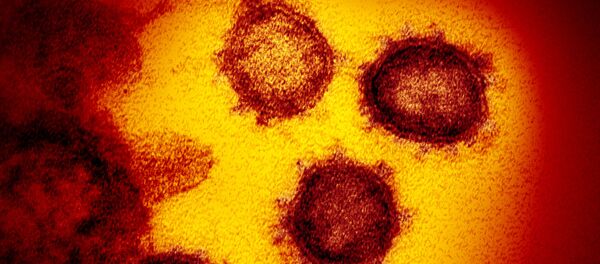 Imagen en color y alta resolución del SARS-CoV-2  - Sputnik Việt Nam