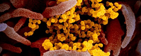 Цветное изображение нового коронавируса SARS-CoV-2 Цветное изображение нового коронавируса SARS-CoV-2 - Sputnik Việt Nam