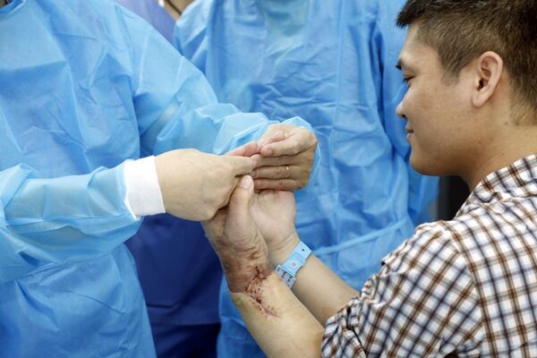 Ca ghép chi thể đầu tiên trên thế giới từ người hiến sống được thực hiện tại Việt Nam Ca ghép chi thể đầu tiên trên thế giới từ người hiến sống được thực hiện tại Việt Nam - Sputnik Việt Nam