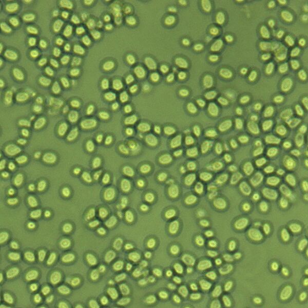 Các bác sĩ phát hiện một người với bàng quang tự sản sinh ra rượu - Sputnik Việt Nam