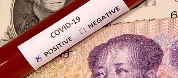 Xét nghiệm coronavirus dương tính trên đô la và nhân dân tệ - Sputnik Việt Nam