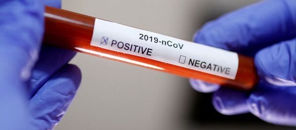 Сoronavirus. - Sputnik Việt Nam