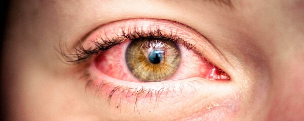 Cô gái mắt đỏ Cô gái mắt đỏ - Sputnik Việt Nam