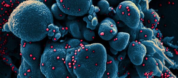 Tế bào nhiễm coronavirus soi dưới kính hiển vi - Sputnik Việt Nam