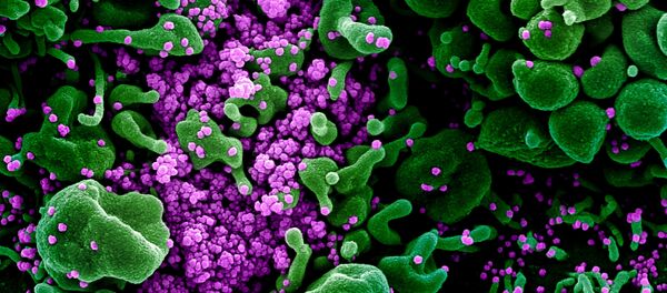 Ảnh vi mô phân tử coronavirus trong tế bào của người bị lây nhiễm  - Sputnik Việt Nam