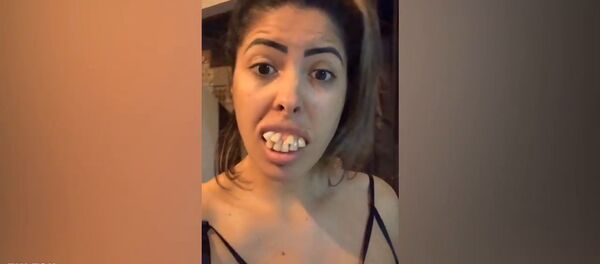 Cô gái cho mọi người «ăn quả lừa» với răng mọc thành hai hàng. - Sputnik Việt Nam