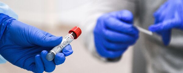 Ống nghiệm có máu xét nghiệm sự hiện diện của kháng thể với virus SARS-CoV-2. Ống nghiệm có máu xét nghiệm sự hiện diện của kháng thể với virus SARS-CoV-2. - Sputnik Việt Nam