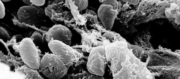 Bệnh dịch hạch. - Sputnik Việt Nam